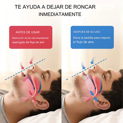 Air Flow Detiene los ronquidos recomendado por médicos de Europa (Original)..