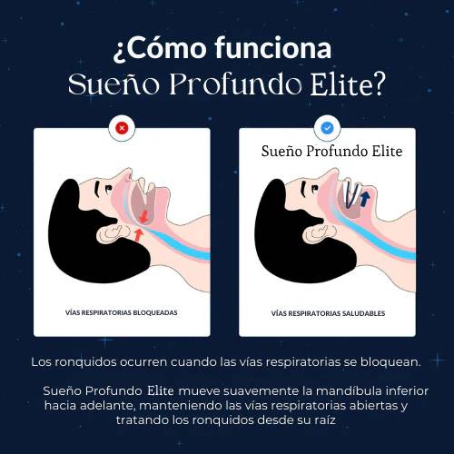 Sueño Profundo Elite™ Dispositivo Bucal Anti-Ronquidos