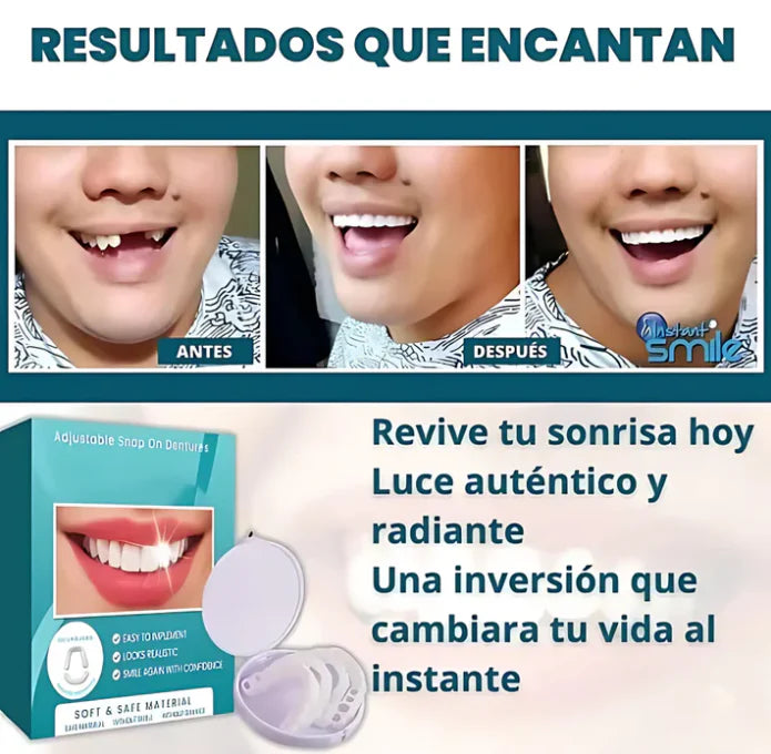 CARILLAS DENTALES FABRICADAS EN RESINA 😍 Superior + Inferior